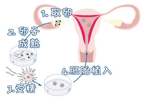 助孕全国招募孕妈志愿者